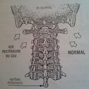 étude des hautes cervicales Chiropratique